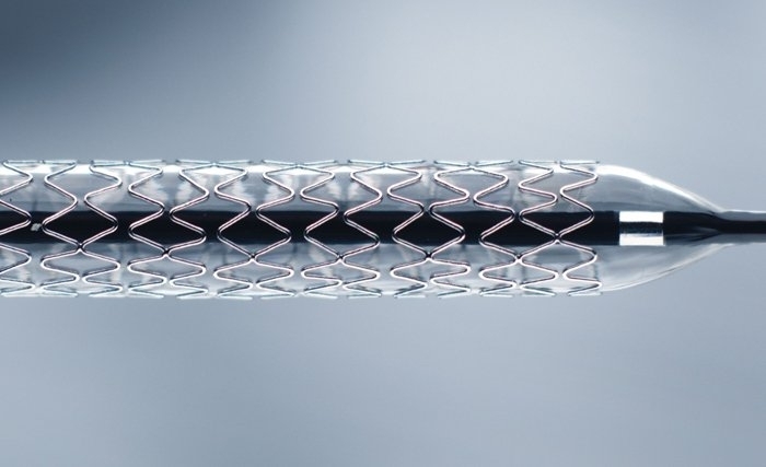 Les stents : comment ça marche ? Les stents : comment ça marche ?