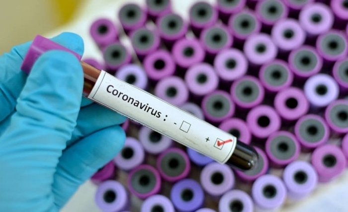 Général El Bekri : Quels risques de contagion par le Coronavirus en Tunisie ? Général El Bekri : Quels risques de contagion par le Coronavirus en Tunisie ?