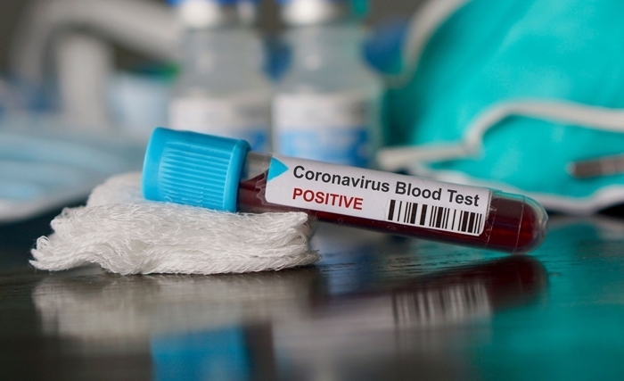 Coronavirus: la situation en Tunisie après "le patient zéro"  
