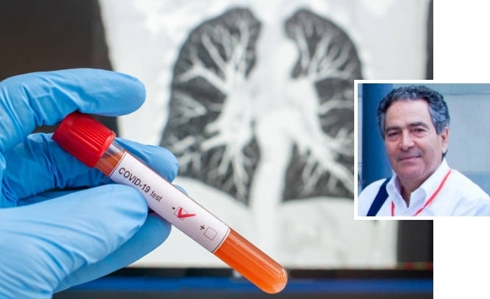 Hatem Masmoudi - Immunité et réinfection par le nouveau coronavirus: entre mythe et réalité Hatem Masmoudi - Immunité et réinfection par le nouveau coronavirus: entre mythe et réalité