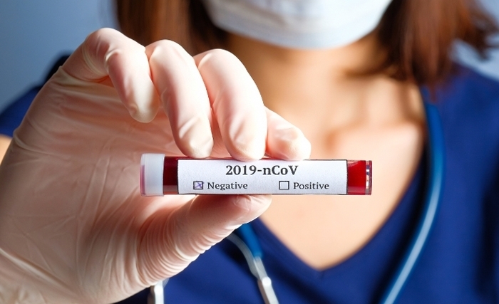 Covid-9 : aucun nouveau cas d'infection sur un total de 319 prélèvements Covid-9 : aucun nouveau cas d'infection sur un total de 319 prélèvements