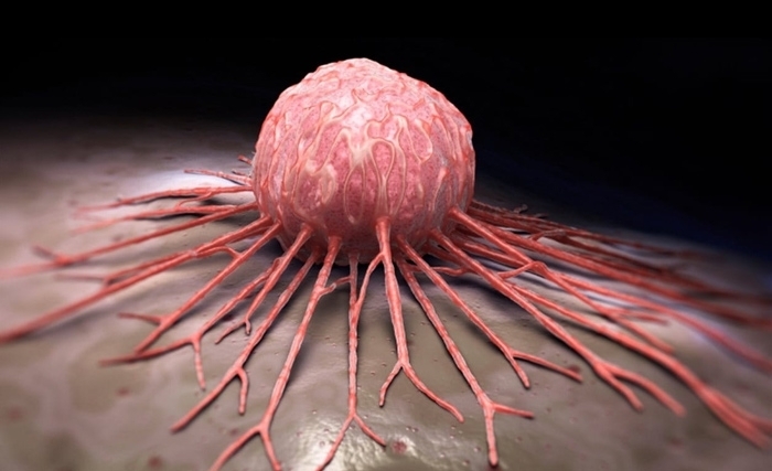 Lassaad M'sahli - Les vaccins contre le cancer du col de l’utérus : de la propagande à la réalité Lassaad M'sahli - Les vaccins contre le cancer du col de l’utérus : de la propagande à la réalité