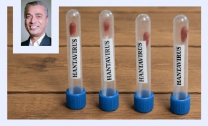 Dr Moez Ben Ali - Hantavirus: entre vigilance scientifique et responsabilité sanitaire mondiale